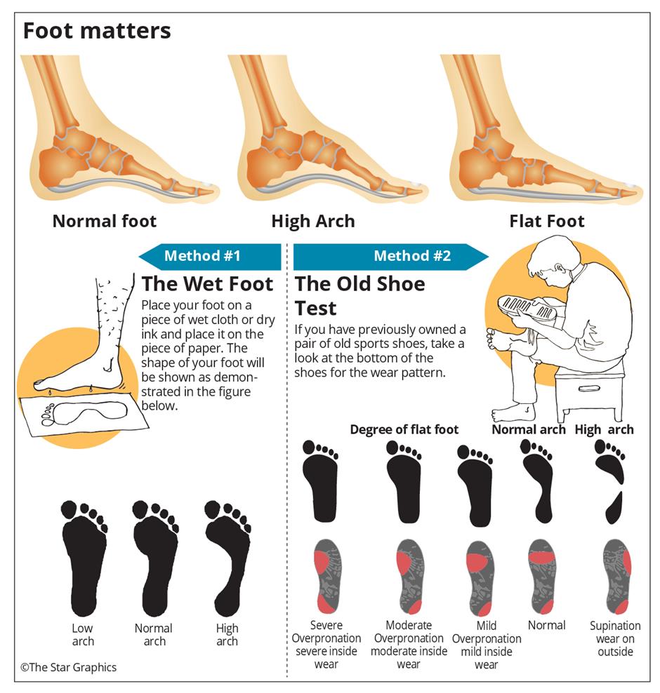 high arch overpronation