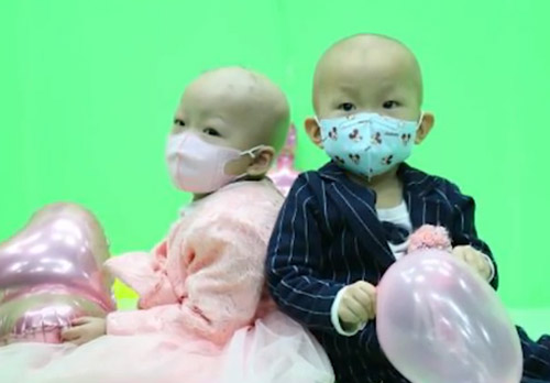 Special Wedding For 2 Year Olds With Leukemia China News