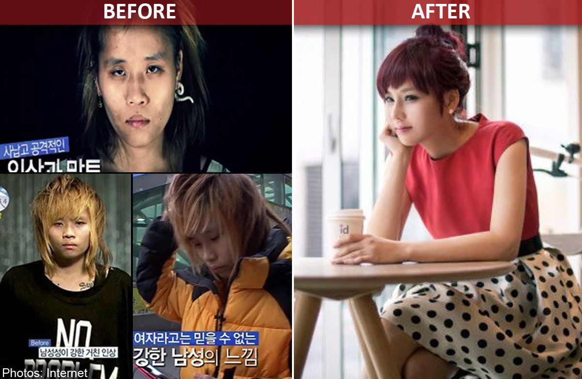 Masculine girl undergoes plastic surgery to look more feminine, Health News  - AsiaOne
