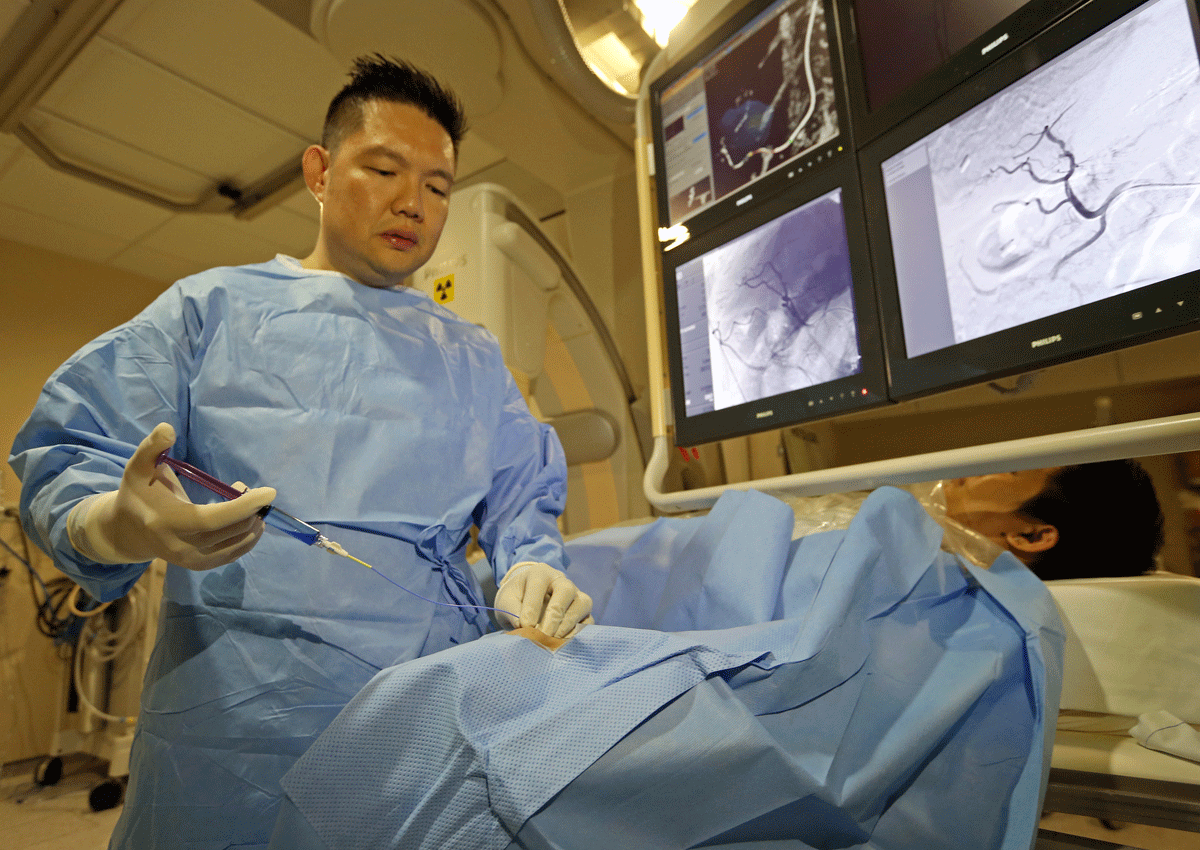 Big relief with new liver cancer technique, Health, Health News AsiaOne