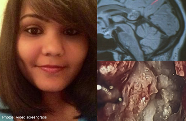 Evil twin's' bones, hair, teeth found in woman's brain, Health News - AsiaOne Evil twin's' bones, hair, teeth found in woman's brain, Health News - AsiaOne