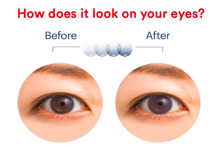 Acuvue Glasses To Contacts Conversion