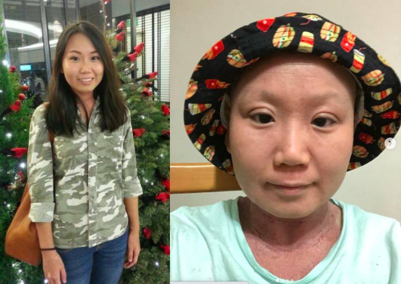 I Know What I M Meant To Do In This Life 28 Year Old Finds Her Calling Through Debilitating Skin Condition Lifestyle News Asiaone