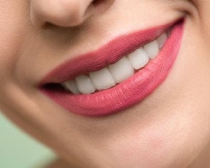 Teeth whitening price guide: Home kits, salons or dentists?