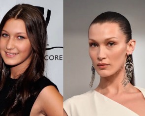 Bella Hadid&#039;s nose job at 14, Kylie Jenner&#039;s lip fillers at 15 - how young is too young for plastic surgery?