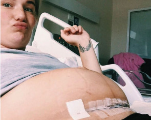 Mother&#039;s post about how &#039;easy&#039; a c-section is goes viral