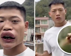 Chinese influencer cancelled after wasp-eating video stunt that causes public outcry and extremely swollen lips