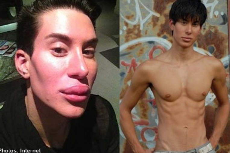 Man has over 90 surgeries to look like a human Ken doll, Health, Health