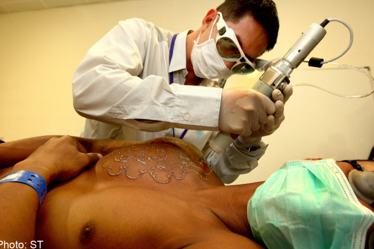 Exdrug addicts get subsidised tattoo removal, Singapore