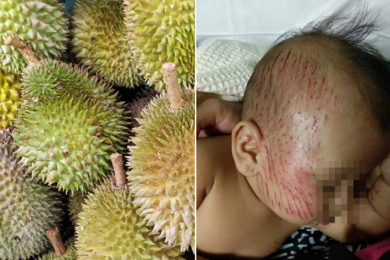 Baby and mother struck by falling durian in Pahang ...