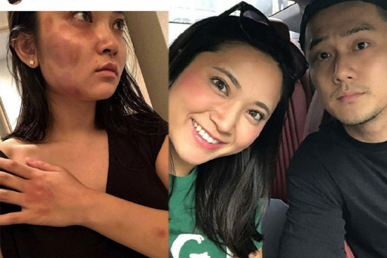 Chinese Actor Jiang Jinfu S Girlfriend Claims She Suffered Miscarriage After Abuse Entertainment News Asiaone