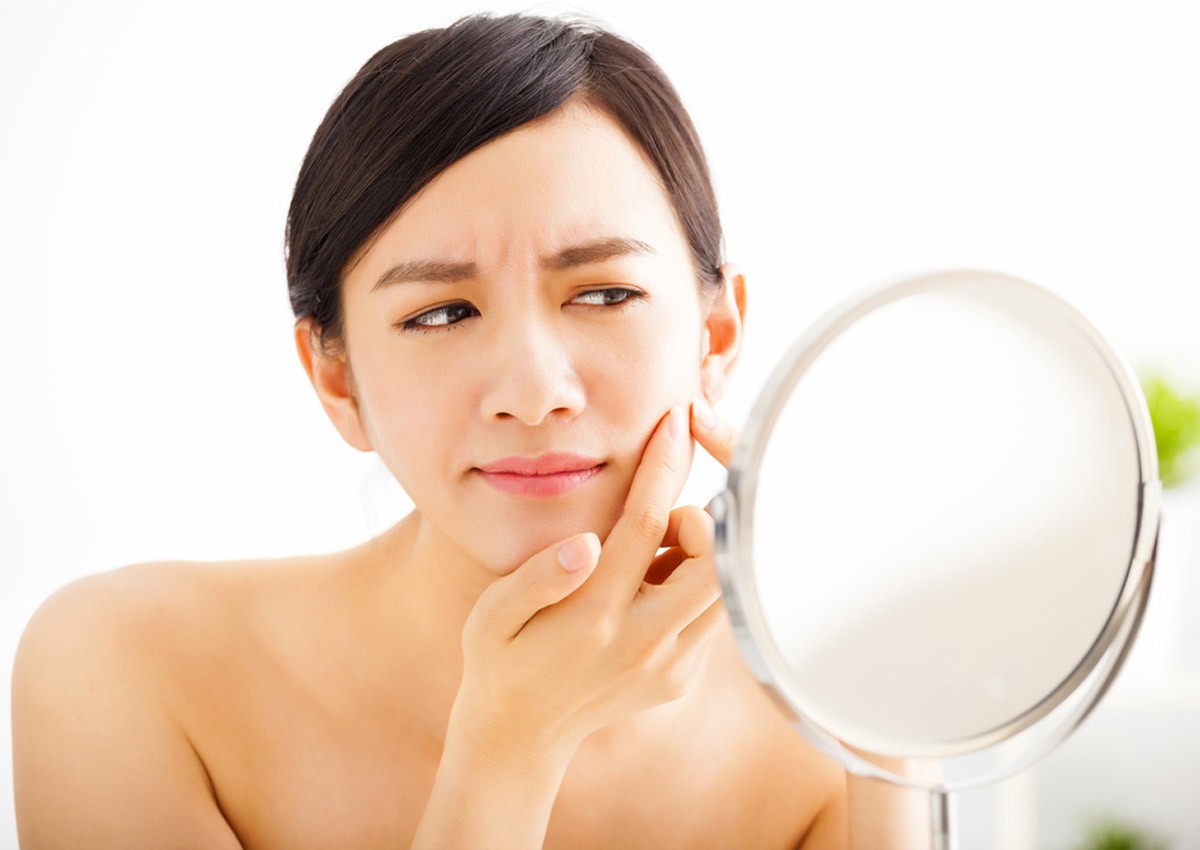 Study links acne with increased risk of depression