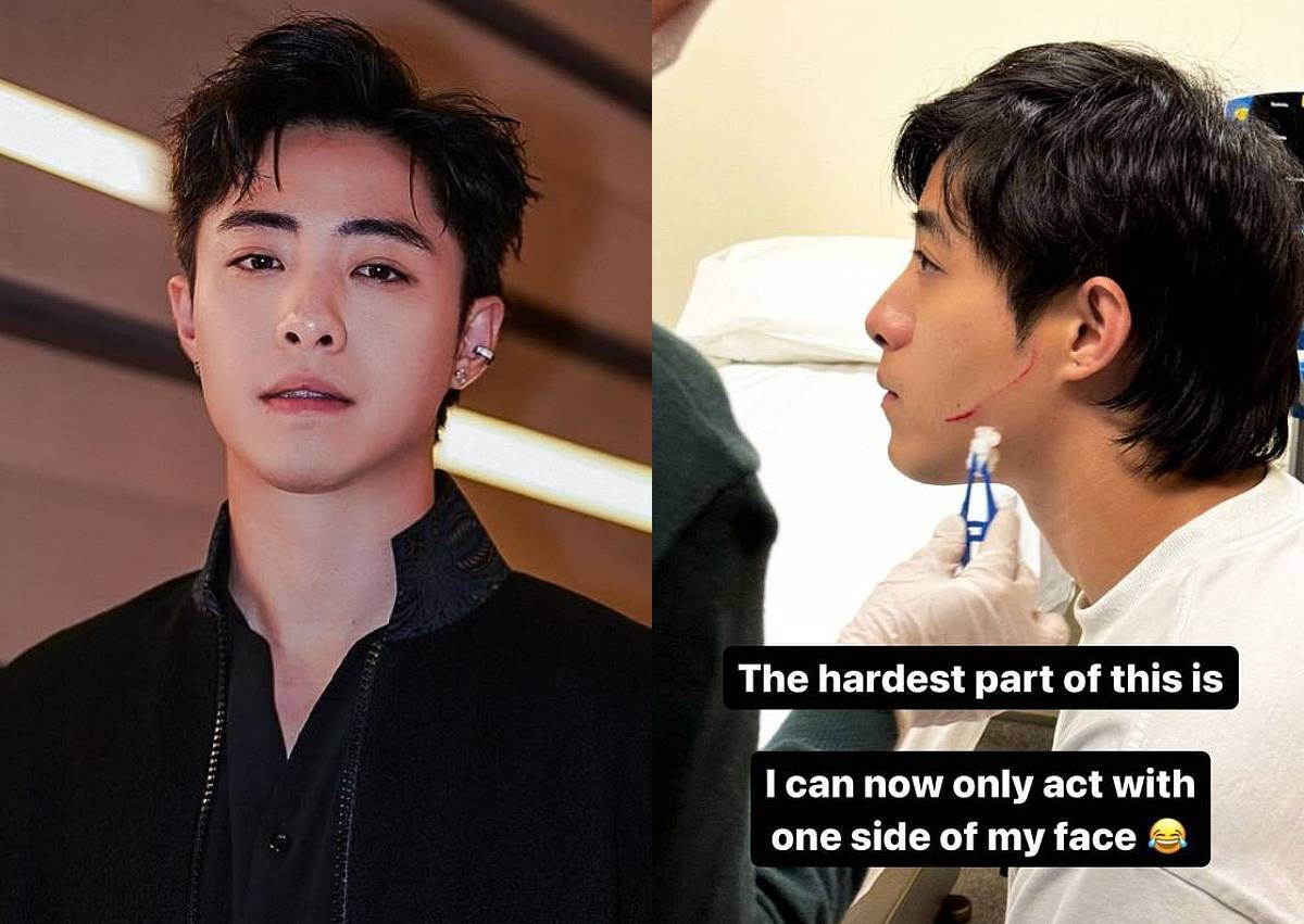 'My face felt hot': Zong Zijie suffers 10cm cut on cheek while filming drama