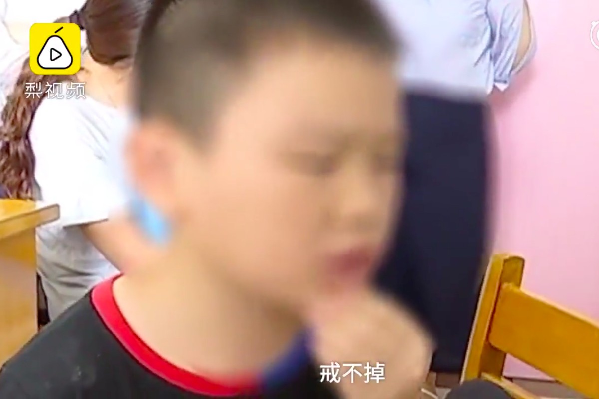 9-year-old boy in China turns cross-eyed after using mobile phone for up to 10 hours a day