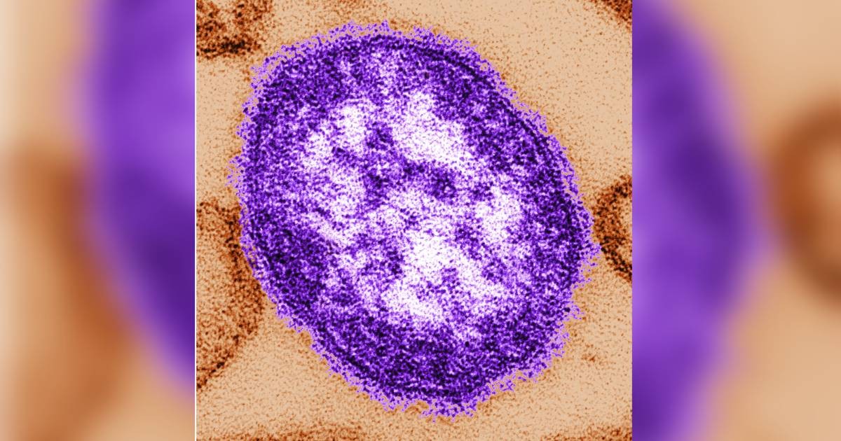 Pennsylvania reports first 2 measles deaths in the US this year, both people unvaccinated