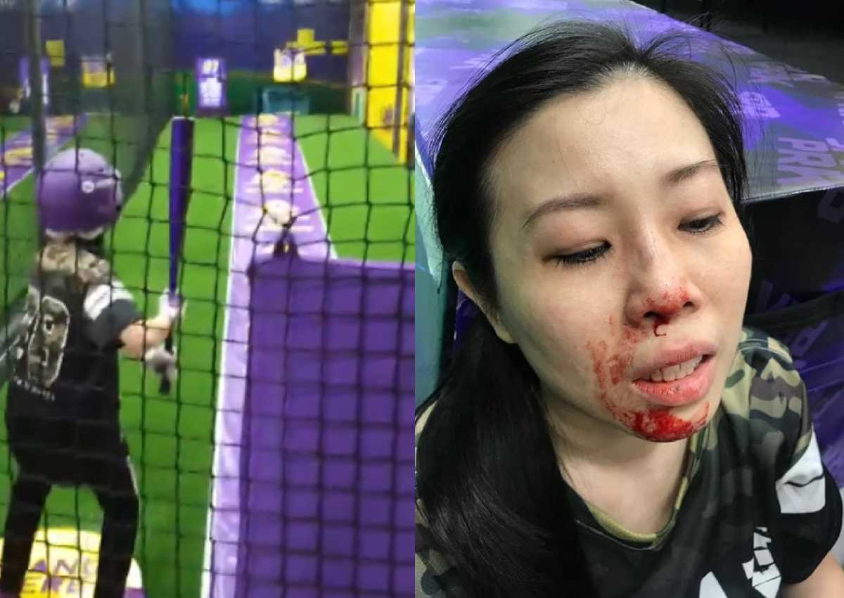 Woman visits SuperPark Singapore, ends up with broken nose