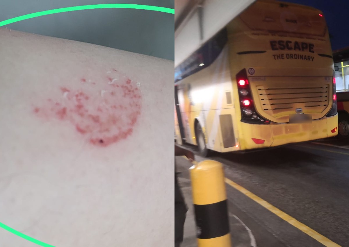 'I was shocked and in pain': Transtar coach driver closes doors on woman's arm, making her fall off bus