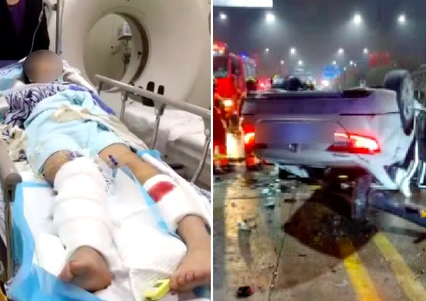 Marry me if you want compensation, says drink driver who caused Chinese woman to lose leg