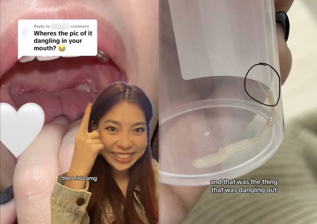 'The doctor couldn't believe it': Woman ends up in A&E over beansprout stuck in throat