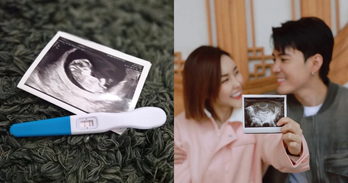 entertainment Desmond Ng and wife expecting 1st child