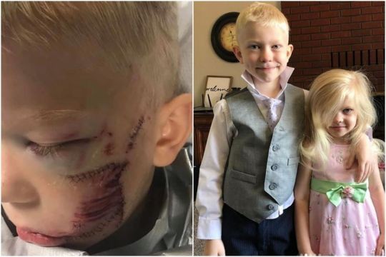 Avengers actor Chris Evans and other stars praise 6-year-old who saved younger sister from charging dog