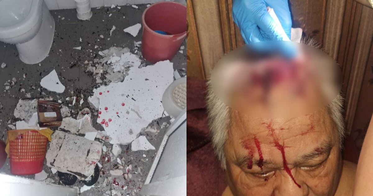 Elderly man left bloodied after concrete from toilet ceiling collapses on him in Yishun home