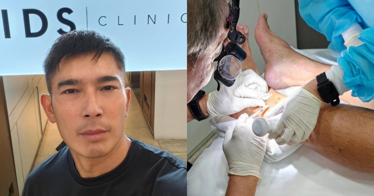 Elvin Ng gets steroid shots after allergic reaction to sandfly bites from months ago