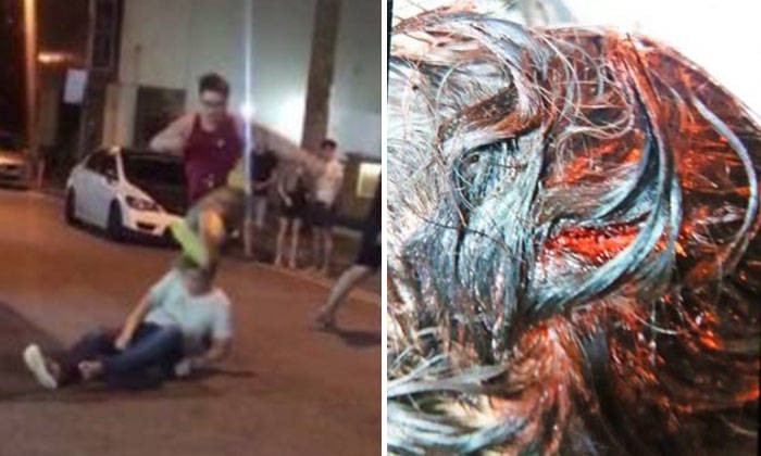 Man who got knocked out in Geylang attack: I just looked at them and they started attacking me