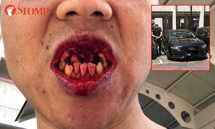 Man suffers fractured teeth after Grab driver punches him during argument over trip cancellation