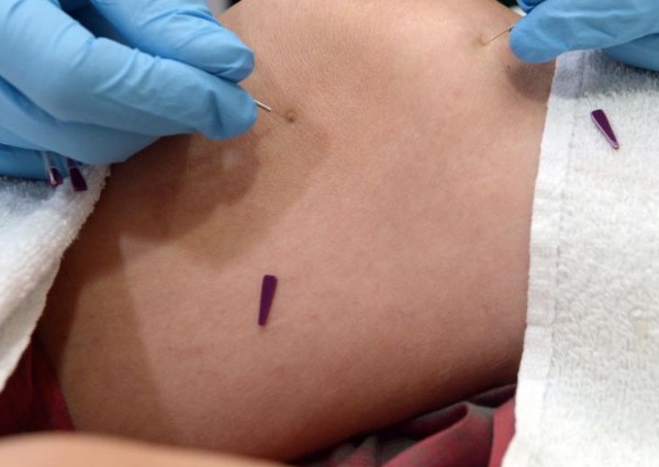 TCM practitioner suspended after treatments caused patient to lose part of leg