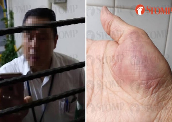 Man who allegedly punched Toa Payoh resident and asked for money to do 'patch work' not from HDB
