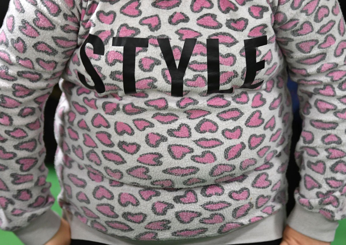 Long-term obesity tied to higher dementia risk in healthy older adults