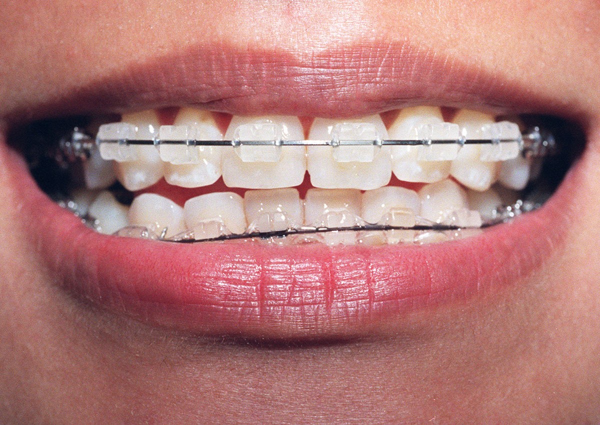 10 most affordable dental clinics in Singapore