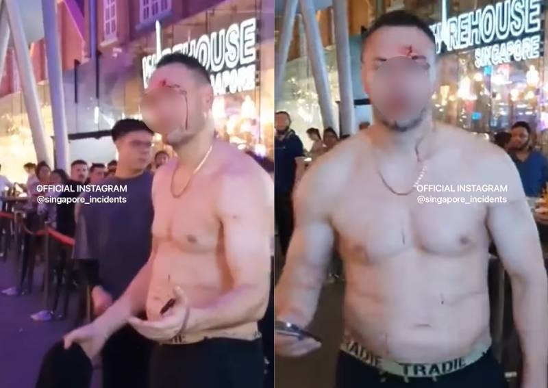 Man left bleeding from head after he was allegedly beaten up at Clarke Quay, 3 men arrested