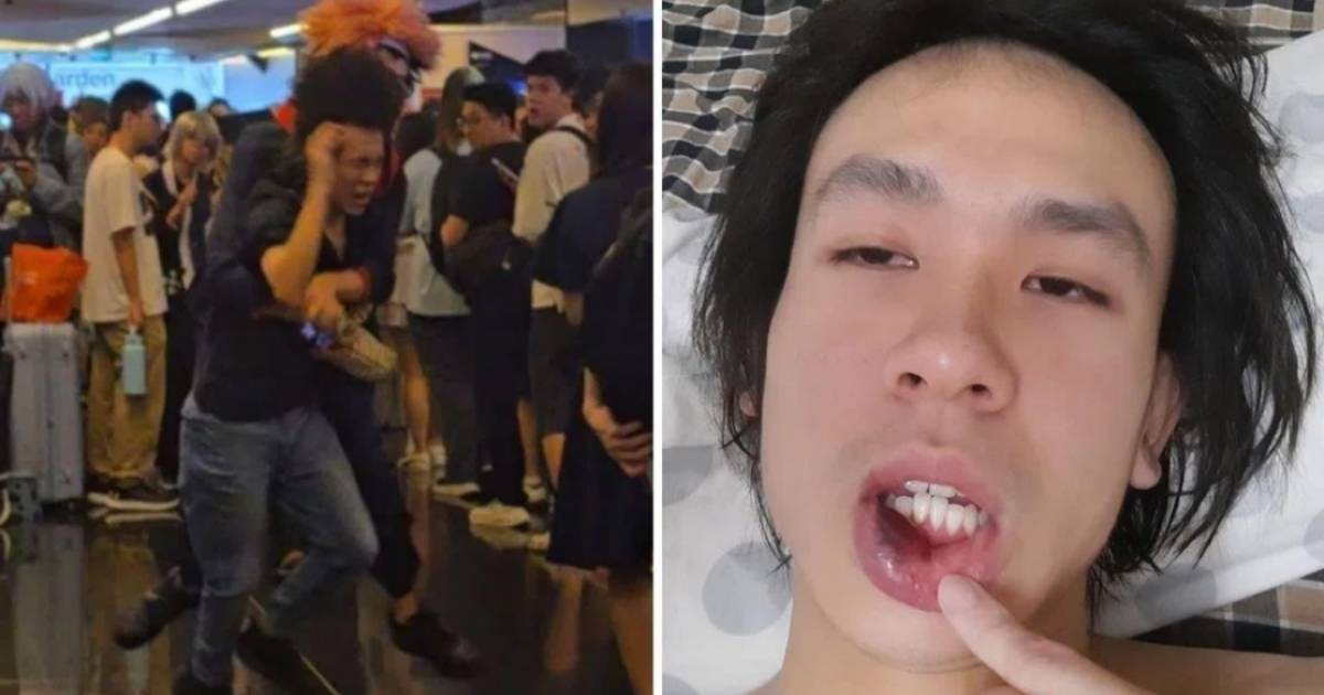 'Pray for him': Amos Yee urges compassion towards attacker, seeks donations for medical expenses