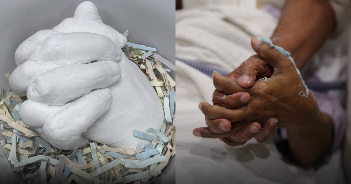 ICU patients and families create hand sculptures as 'lasting symbol of togetherness' at Tan Tock Seng Hospital