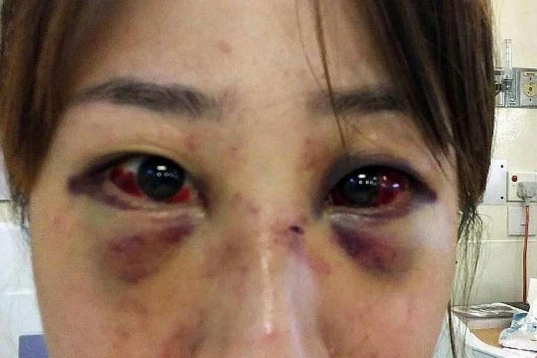 Doctor allegedly beat up ex-girlfriend for refusing to have sex