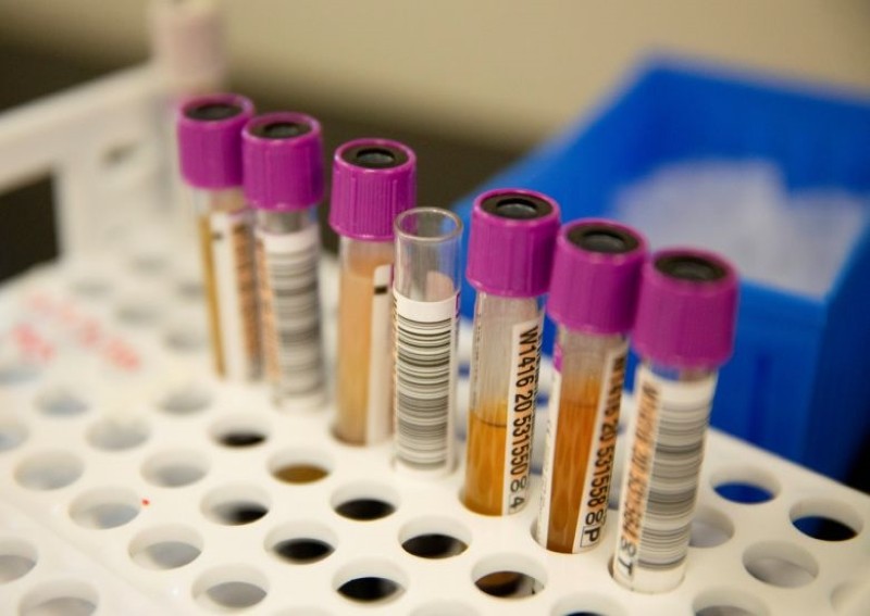 Plasma from recovered patients shows little benefit in those hospitalised with Covid-19: Study