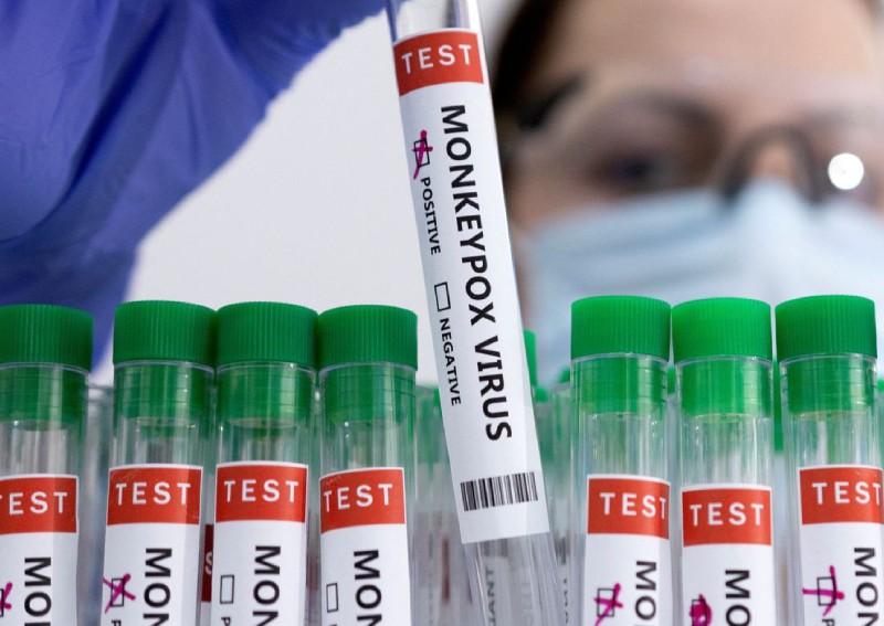 'Considerable' monkeypox transmission happens before symptoms, study suggests