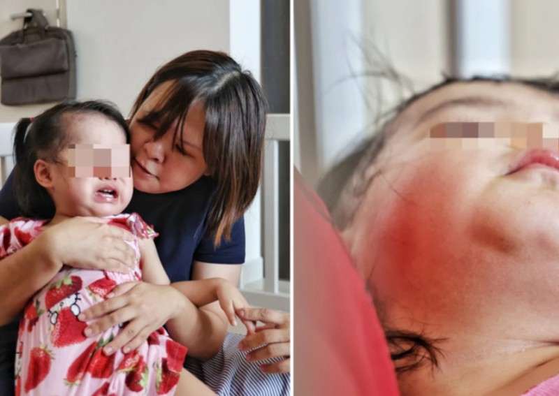 Parents lodge police report against Aljunied pre-school after finding mysterious bruises on toddler