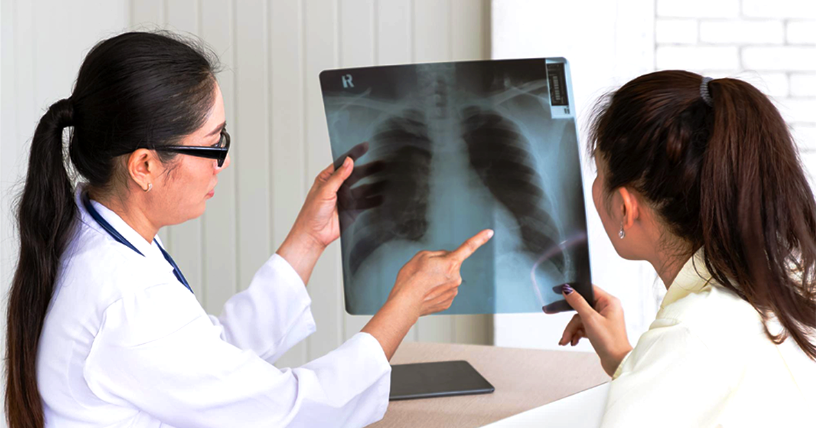 Lung cancer rising among never-smokers; role of PM2.5 exposure being studied: Ong Ye Kung