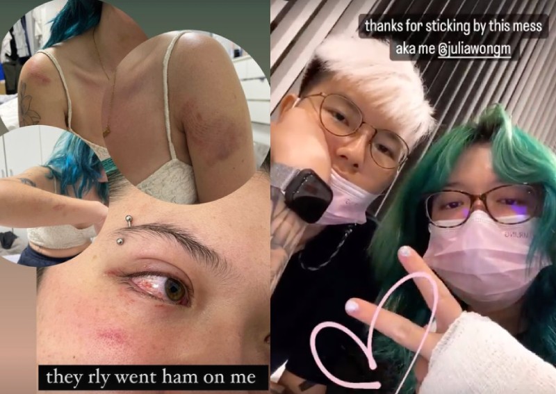 Wrong place, wrong time? 2 women assaulted by group at Marquee puzzled by unprovoked attack