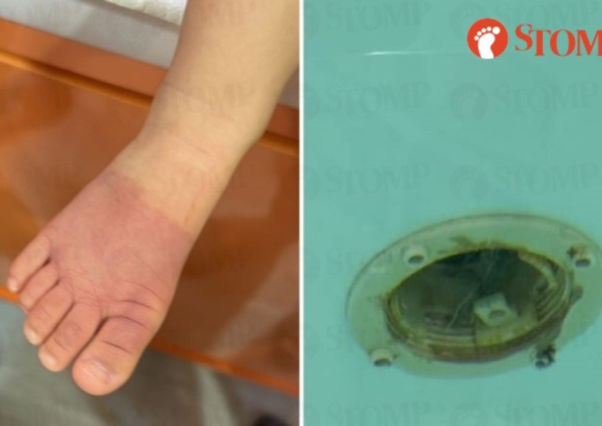'She suddenly burst into tears': Dad on daughter's foot sucked into hole in BabySpa pool
