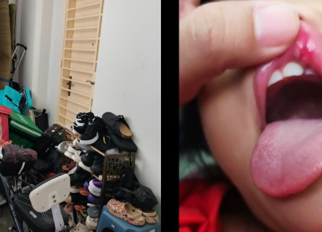 Serangoon resident makes police report after children fall over neighbour's corridor clutter