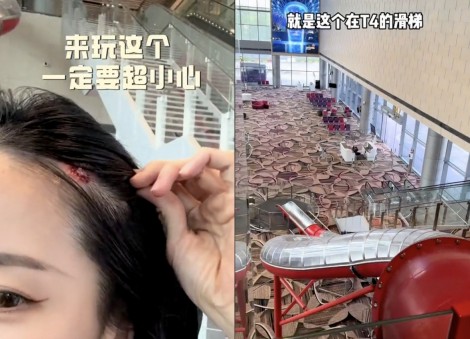 Woman suffers 'painful' cut on head while coming down slide at Changi Airport, thanks air stewardess for help