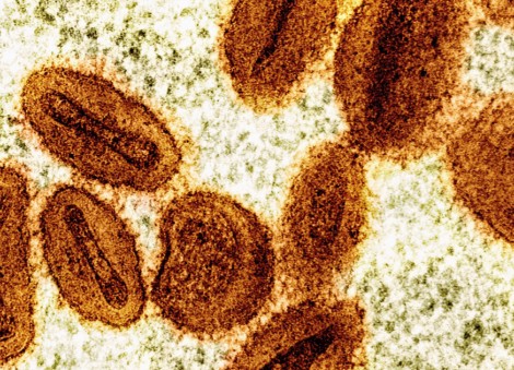 2 scientists charged with bringing deactivated mpox virus into the US and lying to authorities