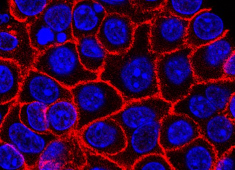 Experimental pill promises new hope for deadly pancreatic cancer