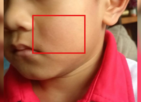 4-year-old boy allegedly slapped twice by man outside Woodlands preschool, police report lodged