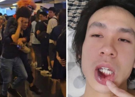 'Pray for him': Amos Yee urges compassion towards attacker, seeks donations for medical expenses