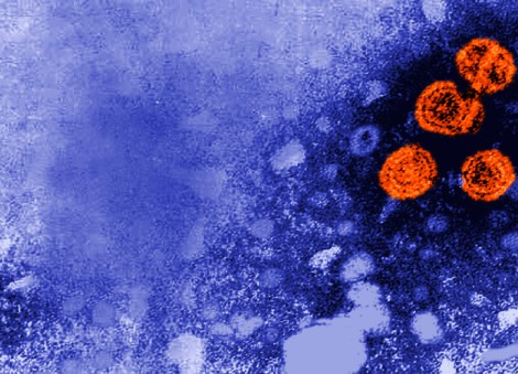 Experimental hepatitis B drug may offer 'functional cure' for some patients